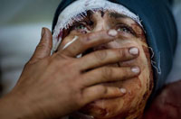 آيدا يكي از هزاران زن&nbsp; سوريه اي، با گريه در حال مشاهده نابودي زندگيش است.  خانه اش ويران شده ، همسر و دو فرزندش کشته شده اند و  خود صدمات زيادي را ديده  است. 
