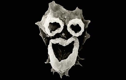 
	آميب مغز خوار : ظاهر صورت مانند بالا يك نوع انگل آبزي كشنده اي بنام "ناگلوريا فولري" است كه از طريق بيني وارد مغز گشته و بافت مغز را از بين مي برد. 
