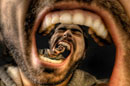 اَکِه هِه... تِق!